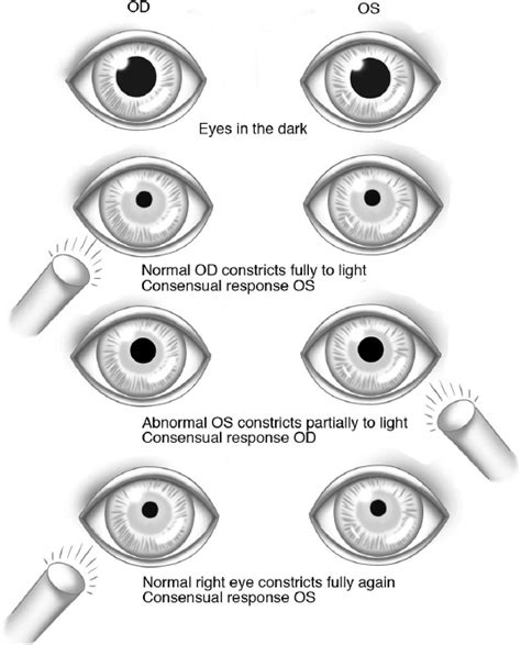 Pupil sizes - whycentre