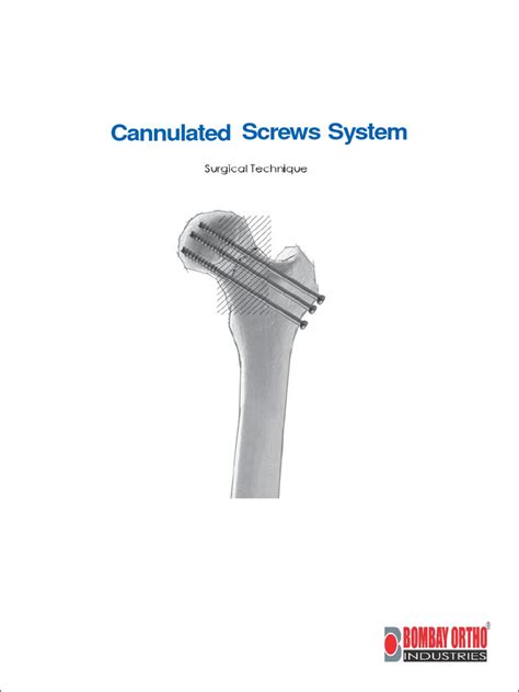 Cannulated Screw Surgical Technique | PDF