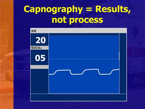 PPT - CPR in the ED: R U Ok? PowerPoint Presentation, free download ...