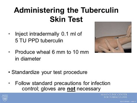 View 25 Mantoux Skin Test Procedure - casevalueimage