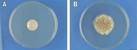 Colony morphology of Trichosporon dohaense strain Myco 194 (CBS 10333 ...