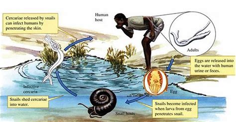 Schistosomiasis causes, symptoms, diagnosis, prevention &andtreatment