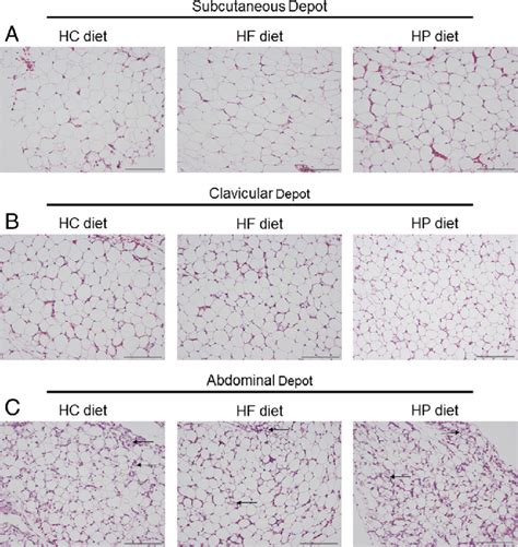 Adipose tissue histology at day 4 post-hatch in (a) subcutaneous, (b ...