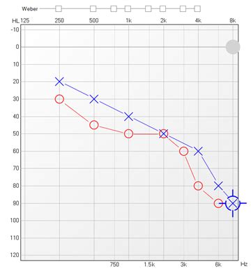 How is an audiogram read? What are decibels? | Boots Hearingcare