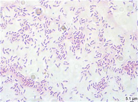 Gram Negative Coccobacilli Versus Rods