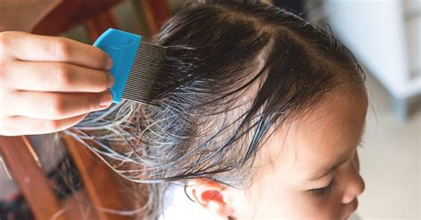 Drug-Resistant Super Lice: Symptoms, Treatment, and Prevention