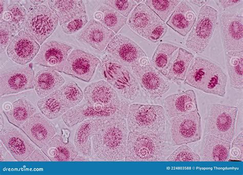 Mitosis Cell In The Root Tip Of Onion Under A Microscope. Stock Image ...