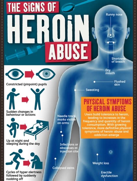 The Signs of Heroin Abuse (Infographic) | Infographics Zone| Submit ...