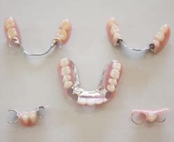 Partial Dentures — Dinos Denture Clinic