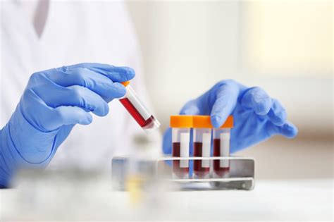 What to Expect During Your First Blood Test - Precision Labs