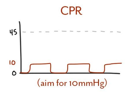 low end tidal co2 during cpr - Has Major Portal Galleria Di Immagini