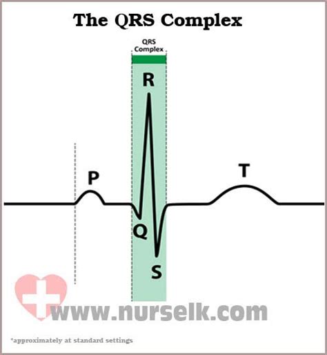 Ekg Qrs Complex