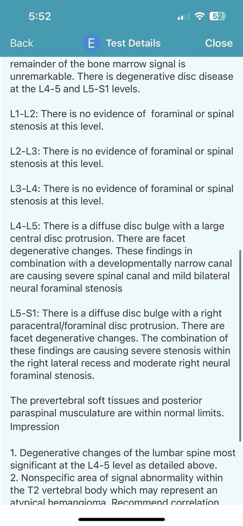 Found my report from MRI : r/Sciatica