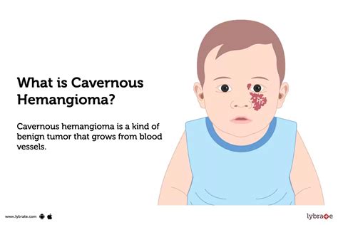 Cavernous Hemangioma: Causes, Symptoms, Treatment and Cost