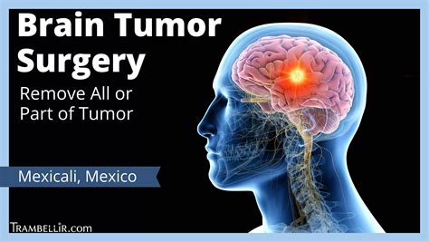 Brain Tumor Surgery (Remove All or Part of Tumor) | Trambellir