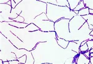 The Gram Stain | Bacillus subtilis, Bacillus, Microbiology