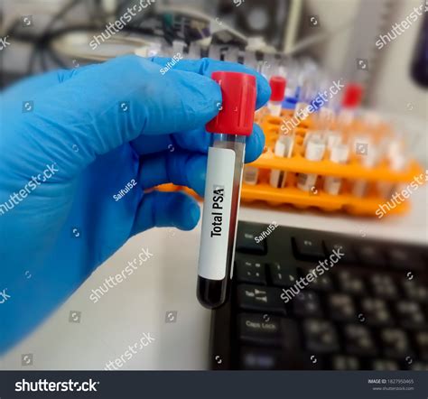 Blood Sample Tube Labeled Text Total Stock Photo 1827950465 | Shutterstock