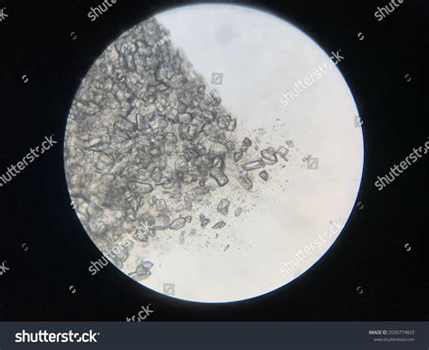 Struvite Crystals Urine Sample Male Cat Stock Photo 2030774825 ...