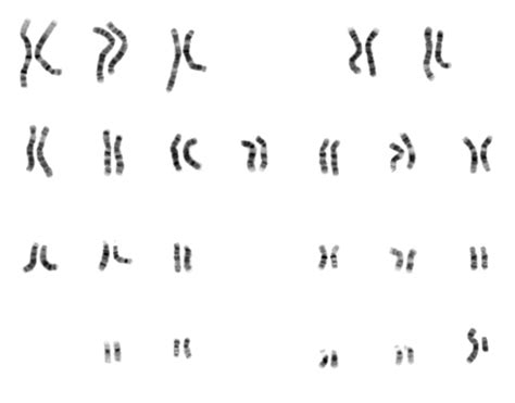 13.1C: Identification of Chromosomes and Karyotypes - Biology LibreTexts