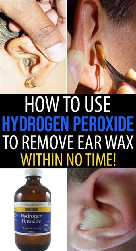 Cleaning ears with hydrogen peroxide - zonejord