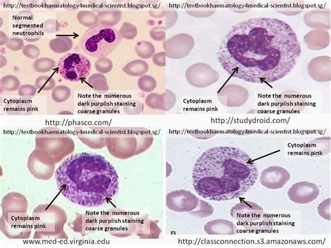 Toxic Neutrophils