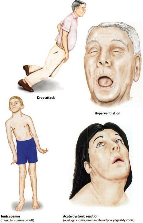 Color Atlas of Neurology | Neurological assessment, Neurological ...