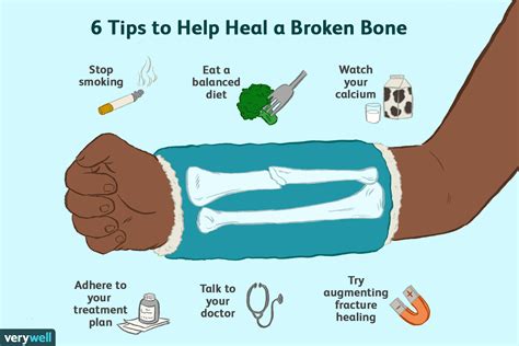 How To Repair A Broken Bone - Longfamily26