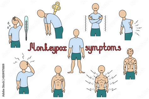 Symptoms of monkeypox. Headache, fever, muscle pain, enlarged lymph ...