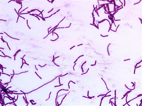 Bacillus Coagulans Gram Stain