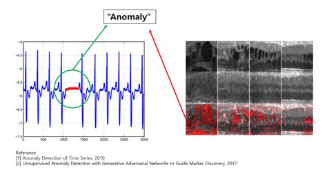 How to Time-series Anomaly Detection Using Deep Learning. | by gudgud ...