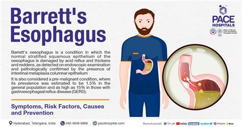 Barrett's esophagus – Symptoms, Causes, Types and Complications