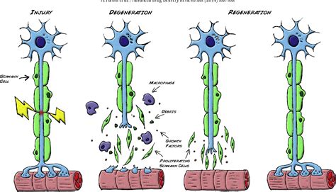 Figure 1 from Peripheral nerve regeneration: experimental strategies ...