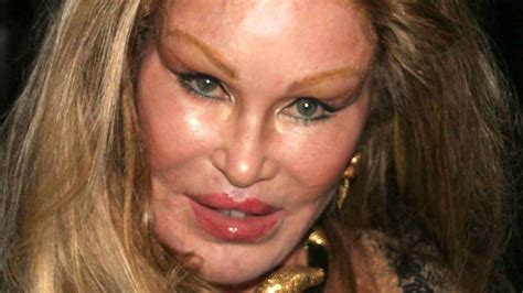 6 Celebrity Cosmetic Surgery Epic Fails - And How to Prevent Them ...