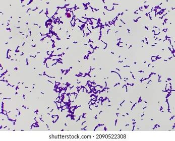 Streptococcus Pyogenes Gram Stain