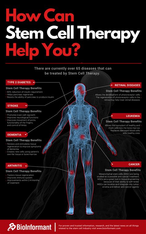 What Diseases Can Be Treated with Stem Cell Therapy | Stem cell therapy ...