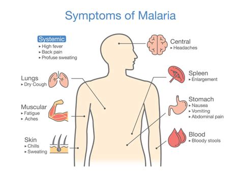 Malaria Information for Travellers: Know This Before Leaving Home | The ...