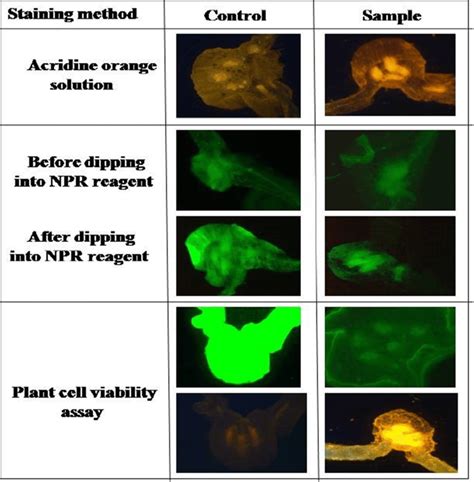 Histochemical analysis: cell permeability changes through acridine ...