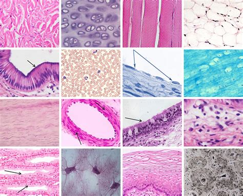 Pick-a-Tissue (Histology Landmine) Quiz - By Fledermaus