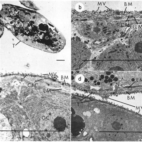 Encapsulated and killed Schistosoma mansoni sporocyst (dark region of ...