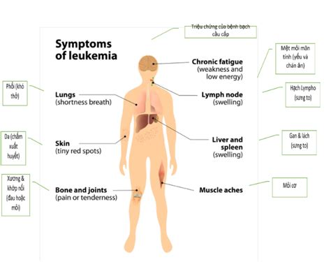 Acute myeloid leukemia | Vinmec