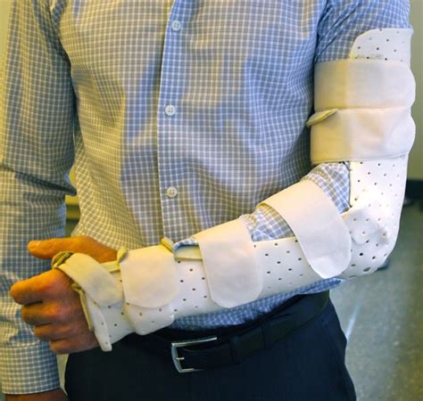 Splint for Olecranon Fracture or Wrist Surgery | Grand Central Physical ...