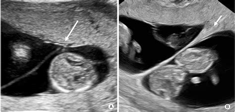 Maternal-Fetal Medicine