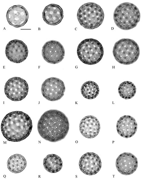 Light microscope (LM) images of selected pollen grains of Suaedoideae ...