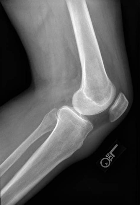 Awesome What Are The 3 Views Of A Knee X Ray Current Issues In Accounting