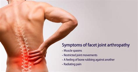 Facet Joint Arthropathy: Symptoms Causes Prevention and Treatment