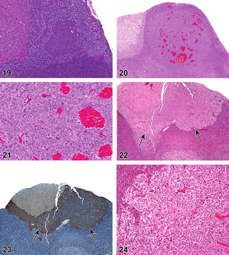 Rat pituitary gland. Hyperplasia, focal, pars intermedia. Figure 20 ...