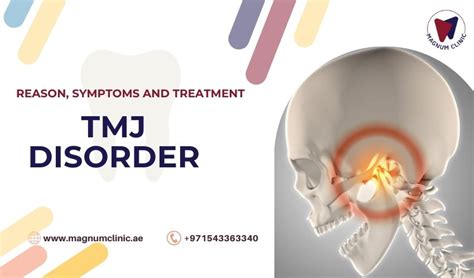 TMJ Disorders: Reason, Symptoms And Treatment