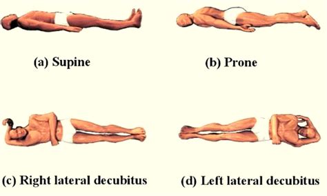 Right lateral position tied to faster esophageal acid clearance in GERD ...