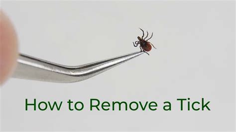 Mayo Clinic Minute: Tips To Best Remove Ticks, 48% OFF