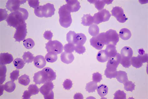 Plasmodium Falciparum Under Microscope